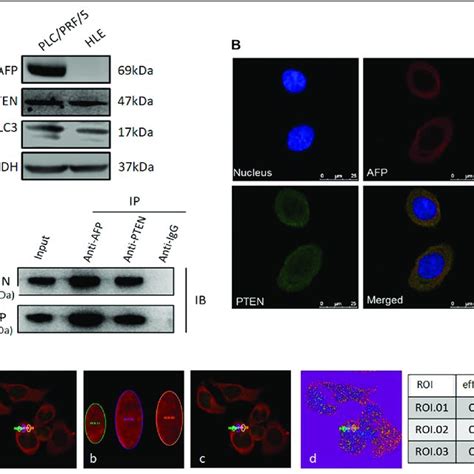 The Effect Of Afp On Hcc Cell Growth In Vivo And In Vitro A Plc Prf