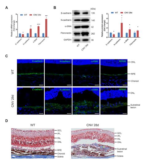 Emt Of Rpe Cells And Subretinal Fibrosis Are Observed On Day After