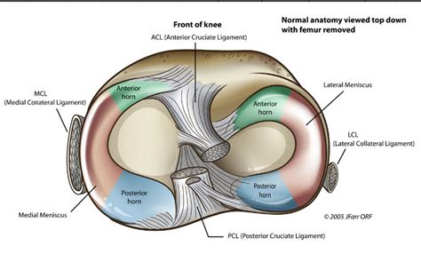 Meniscal Tears