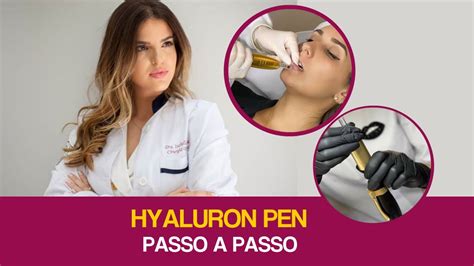 Curso Hyaluron Pen Aprenda Hyaluron Pen Passo A Passo A Dra