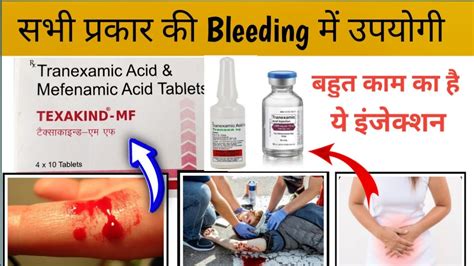 Trenexamic Acid Injection Uses In Hindi Texakind Tranexa Injection