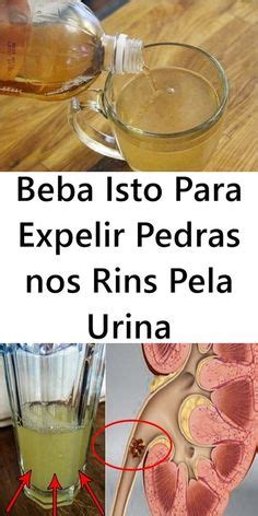 Beba Isto Para Expelir Pedras Nos Rins Pela Urina