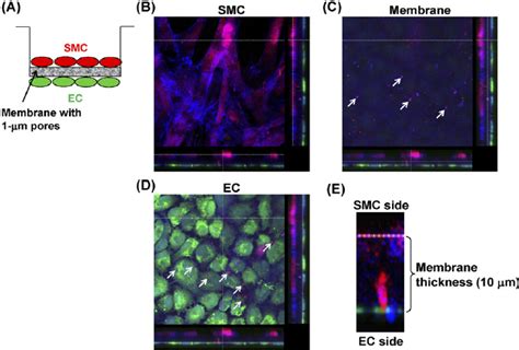 Fig S1 Smcs Penetrate Through The 1 μ M Pores Of The Coculture