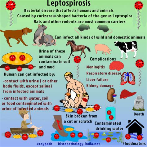 leptospirosis symptoms in humans - Anna Mathis