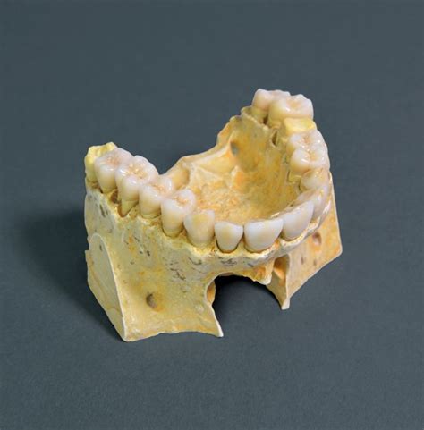 all-porcelain-ips-emax | Cipta d.lab