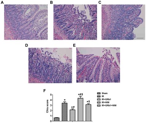 Ginsenoside Rb Attenuates Intestinal Ischemia Reperfusioninduced