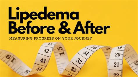 lipedema keto before and after – Sturdy Woman