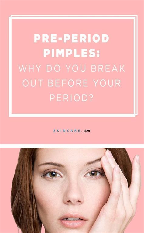 Pre Period Pimples Why Do You Break Out Before Your Period Pimples