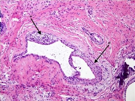 H And E Stained Biopsy Specimen At 40x Showing Multiple Epithelium Lined Download Scientific