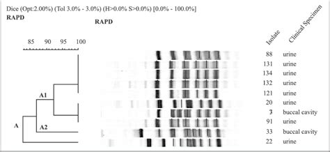 Dendrogram Of T Asahii Obtained From Rapd Molecular Patterns With