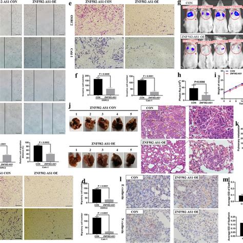 Znf As Overexpression Inhibited Cell Migratory And Invasive Ability