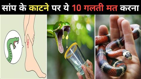 सांप काट ले तो ये 10 गलतियां कभी मत करना How To Survive A Snake Bite