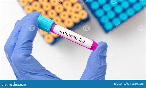 Testosterone Hormone Test Result With Blood Sample In Test Tube On