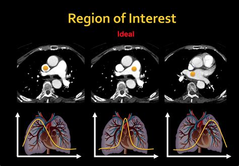 Details Mdct Au Multi Detector Computed Tomography