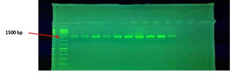 Agarose Gel Electrophoresis Of S Rrna Gene With Bp Dna Ladder