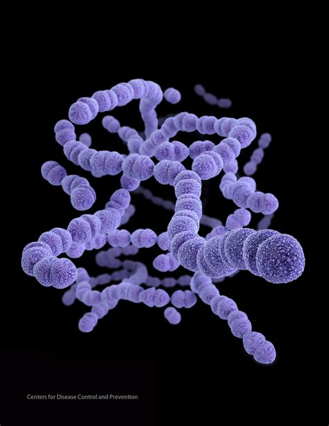 Streptococcus pneumoniae