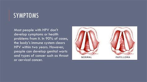 Ppt Hpv Genital Wartscancer Powerpoint Presentation Free Download Id2455673