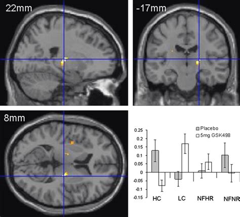 Functional Magnetic Resonance Imaging Fmri Results Day 28 Download Scientific Diagram