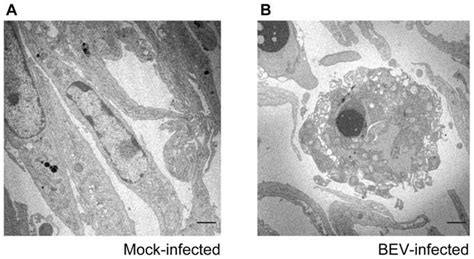 Electron Microscopy Of Bev Infected E Derm Cells E Derm Cells Were