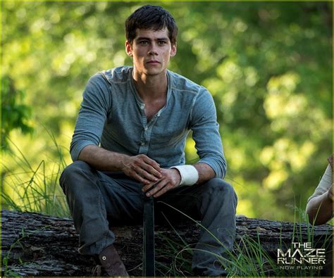 Full Sized Photo Of Dylan Obrien Severely Injured On Maze Runner Set 09