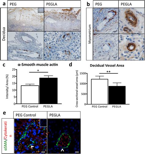 Lif Inhibition During Placental Development Impairs Spiral Artery