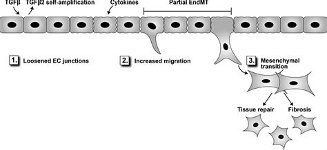 Endothelial Mesenchymal Transition In Cardiovascular Disease