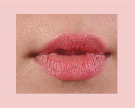 Bump On Upper Lip