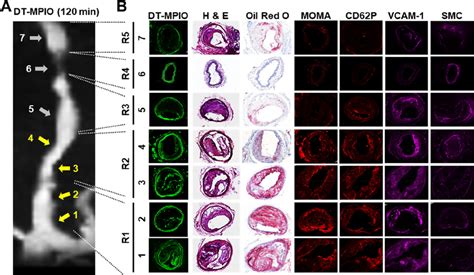 Histological Analysis Of All Regions In Rcca A The Post Contrast