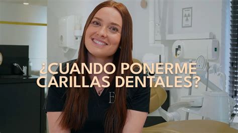 Tipos De Carillas Dentales Gu A Completa Eugenia Cervantes