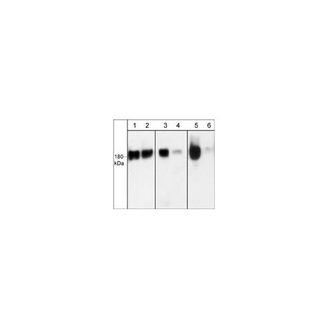 Egfr Phospho Regulation Antibody Sampler Kit