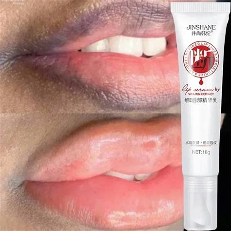 Fast Lightening Pink Mouth Lips Serum Bleaching Permanent Pinkish