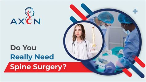 How To Know If You Really Need Spine Surgery