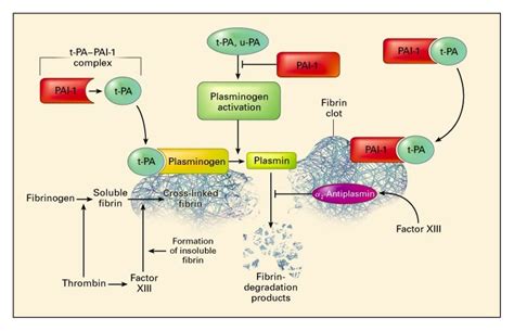 Plasminogen Activator Inhibitor Type And Coronary Artery Disease Nejm