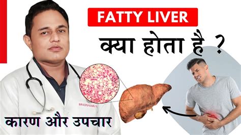 Fatty Liver Kya Hota Hai L Fatty Liver Treatment L Dr Mohit Vohra L