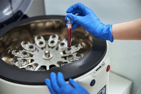 Centrifugation Rpm Vs G Force Kalstein