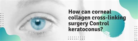 How Can Corneal Collagen Cross Linking Surgery Control Keratoconus