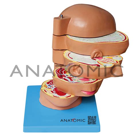 Cabeça em Disco Corte Axial em 5 Partes