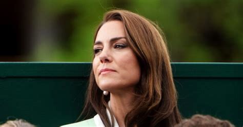 Kate Middleton Cos Lileostomia A Cui Si Sarebbe Sottoposta