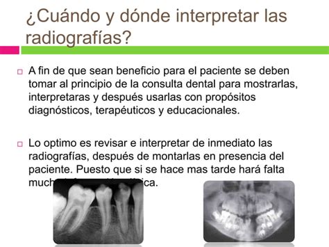 Montaje Y Observaci N De Radiograf As Ppt Descarga Gratuita