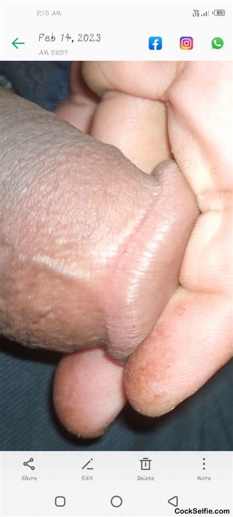 Papules Dick Posted To Cock Selfie