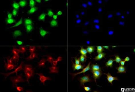 Capicua Antibody Bsa Free Novus Biologicals Ml Unlabeled