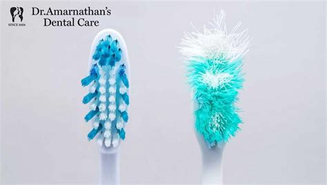 Why We Should Replace Toothbrush Every Months