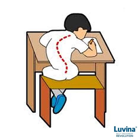 Kifosis Luvina