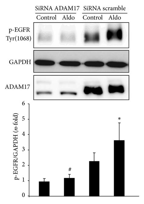 Adam Inhibition Blocks Aldosterone Mediated Egfr Activation In