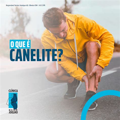 O que é canelite