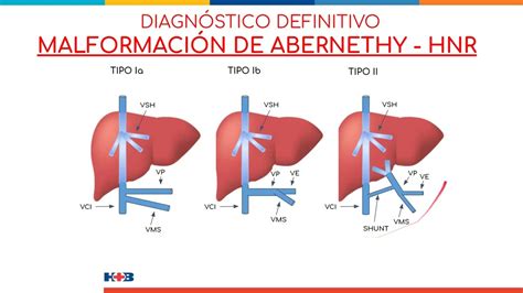 Caso Del Mes N Marzo Malformaci N De Abernethy Dr Mart N