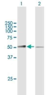 Complement Factor MASP3 MASP1 Antibody H00005648 B01P Novus Biologicals