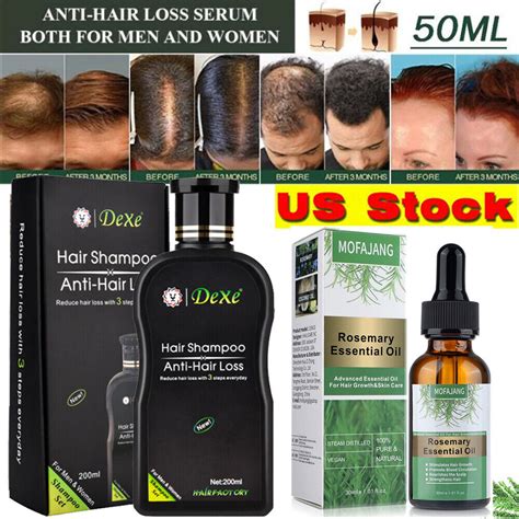 Buy Dexe Original Anti Hair Loss Shampoo Organic Rosemary Serum Oil