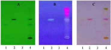 Tlc Chromatogram Of Andrographis A Observed Under Uv Light At 254 Download Scientific