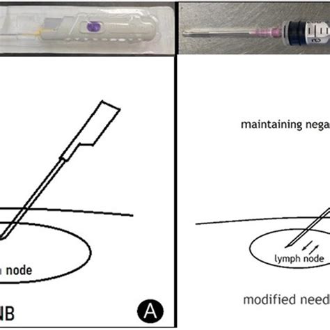 The Visuals Of Both Methods A Core Needle Biopsy Cnb Use Bard Download Scientific Diagram